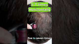 How to Derma Roll for Quickest Hair Results #dermaroller #microneedling  #minoxidil