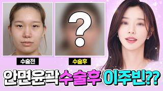 지금 당장 예약하고~ 상담부터!  노종훈성형외과 리얼솔직 이야기!