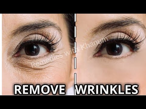 Best Home Remedies For Wrinkles | Anti-Aging OIL & Drink for Skin Tightening, 100% Effective Video