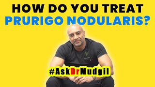 HOW DO YOU TREAT PRURIGO NODULARIS?