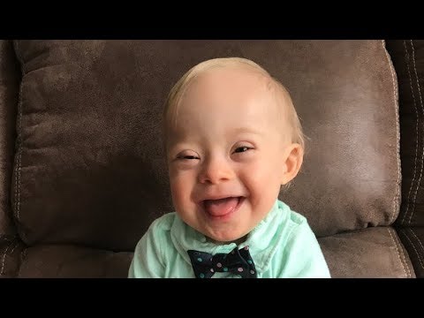 Meet Lucas, the first Gerber baby with Down syndrome