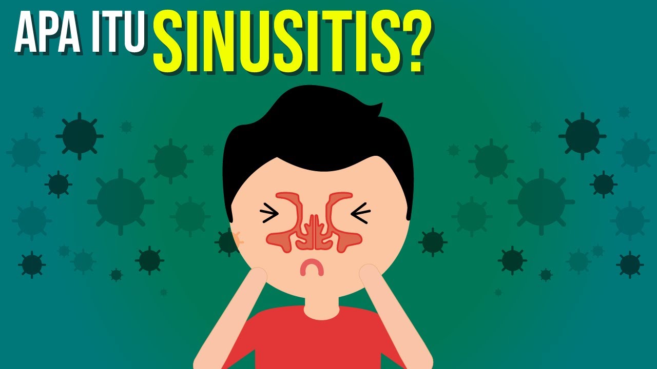 Lihat Apa Itu Sinus Apa Itu Sinus