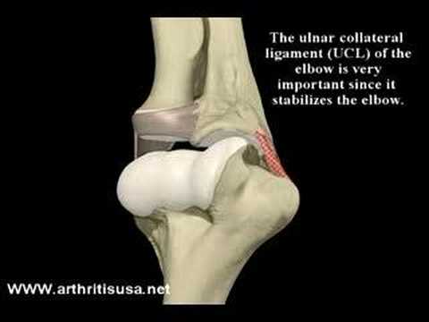 What is Pitcher's Elbow? What is Ulnar Collateral Ligament?