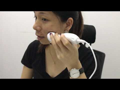 HIFU Wrinkle removal device TB HF04