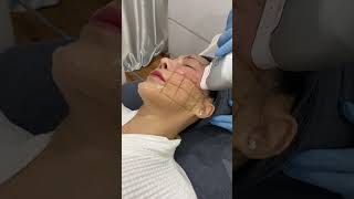HIFU Treatment