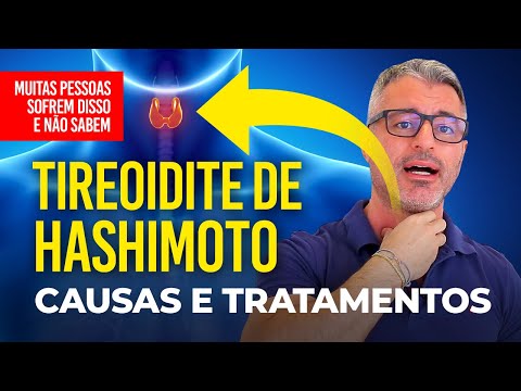 Tireoidite de Hashimoto: Sintomas, Causas e Tratamentos