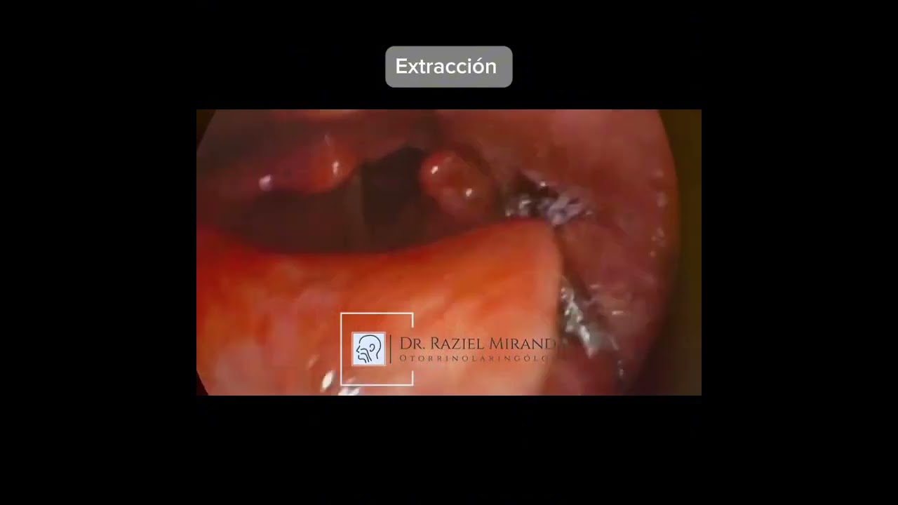 Raziel Yamil Miranda Escobar-19