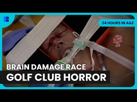 Golf Club Smashes Mans Face Critical Brain Injury | 24 Hours in A&E