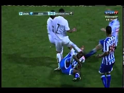 Player suffers severe fracture in Brazil ( Avai x Bragantino)