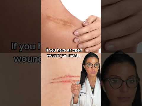 How To Treat Scars According to a Dermatologist #shorts
