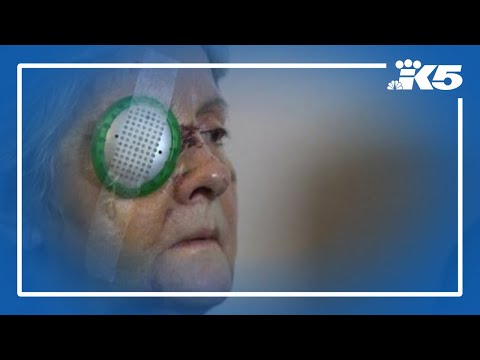 Woman recounts violent attack in downtown Seattle