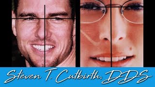 Aesthetic Concepts: Should Midline be Corrected with Veneers?