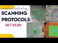 OCT SCANNING PROTOCOLS made easy || line scan, macular cube, raster scan