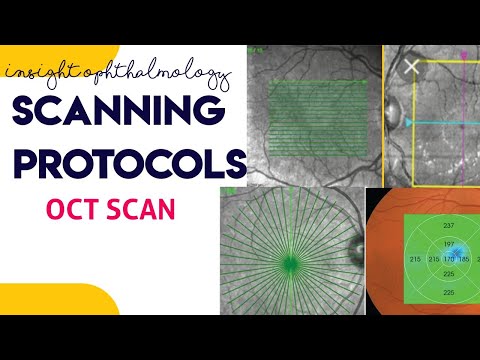 OCT SCANNING PROTOCOLS made easy || line scan, macular cube, raster scan