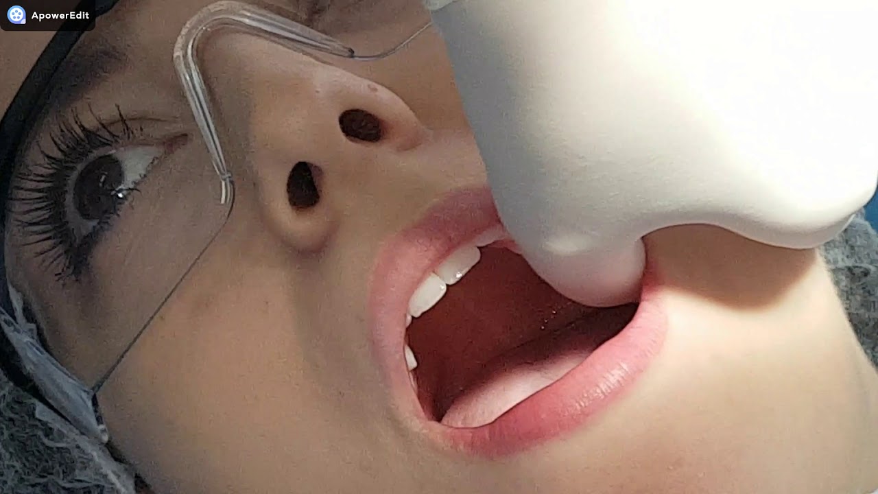 Técnica Anestésica Infiltrativa