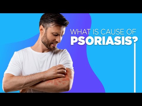 What is the main cause of psoriasis?