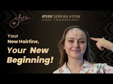 Your New Hairline, Your New Beginning!