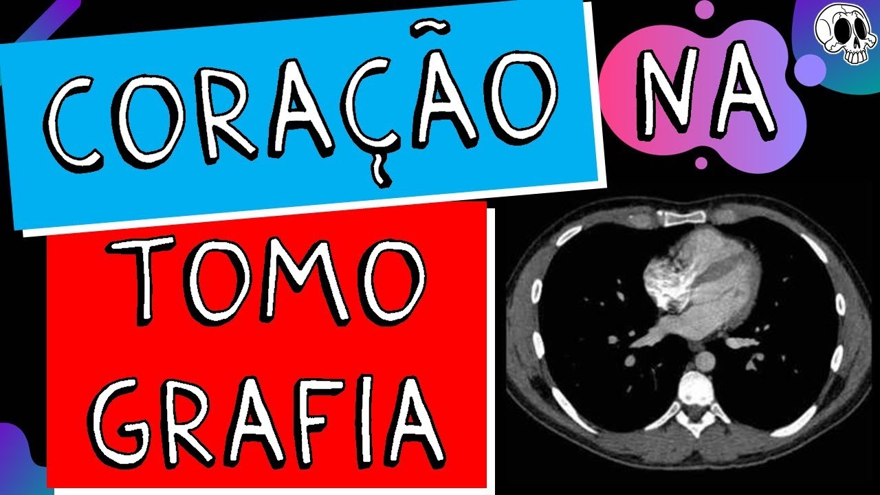 Anatomia do Coração por Tomografia
