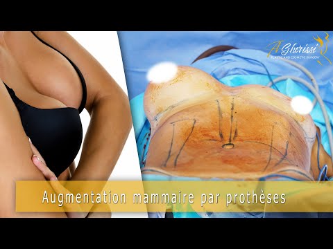 Lifting mammaire et augmentation mammaire