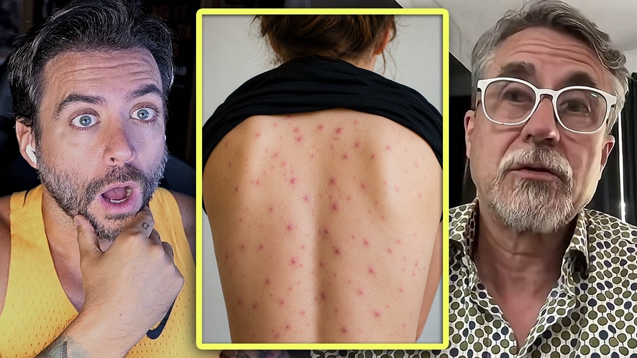 El VIRUS que podría causar una crisis mucho peor que el HANTAVIRUS - Catedrático lo explica
