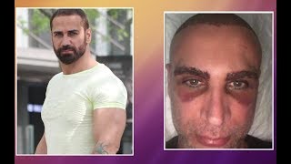 Doğuş'un yeni görüntüsü korkuttu! - Müge ve Gülşen'le 2. Sayfa