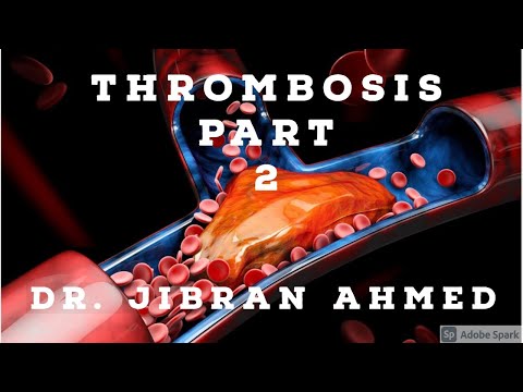 GENERAL PATHOLOGY II EDEMA EFFUSIONS HYPEREMIA CONGESTION II CHAP 4 II ROBBINS 10TH EDITION