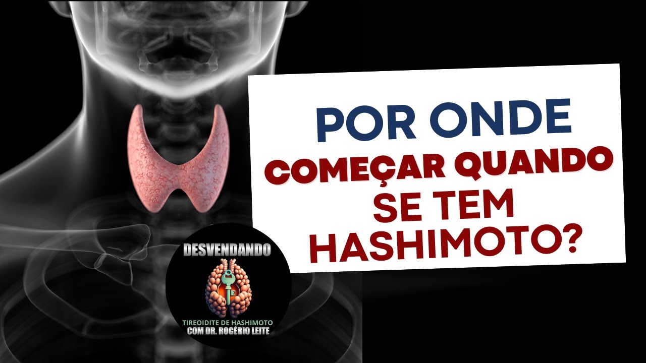 Por onde começar quando se tem Hashimoto?