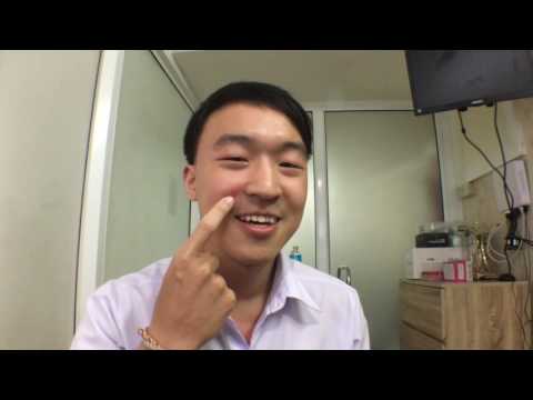 สัญญาณมือนิ้วกลาก Sinaflana จากโรคสะเก็ดเงินที่เล็บ