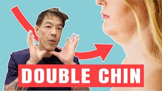 How to Get Rid of a Double Chin | Dr Davin Lim