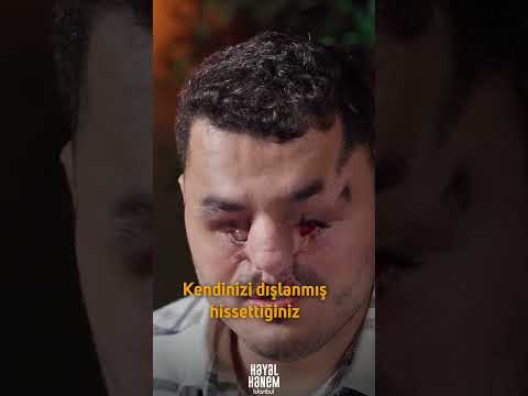 Yüzümden Dolayı Bana Tekme Attı! - Doğuştan Görme Engelli