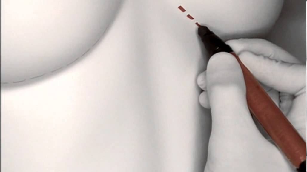 Nip/Tuck - Opening Credits 