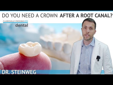 Do I Need Dental Crown After A Root Canal? 🤔
