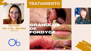 Tratamientos para los GRÁNULOS DE FORDYCE