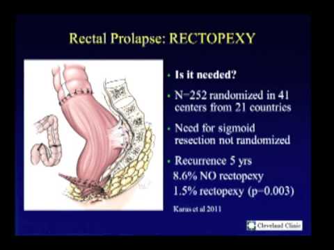 Surgical Management of Recurrent Rectal Prolapse from the SAGES Video Library