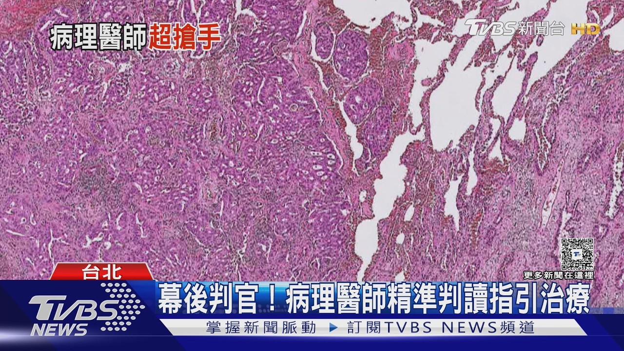 影音/不直接看診卻是幕後判官!揭密病理醫師 如何判讀腫瘤、揪出癌細胞!