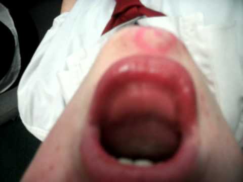 Ruairidh's Vindaloovian.