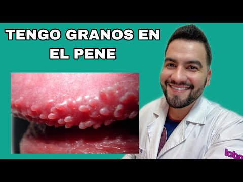 Gran Penes