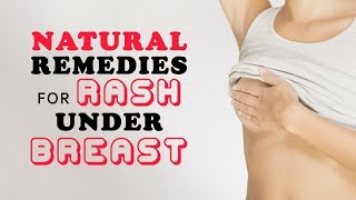 10 Natural Remedies for Rash Under Breast