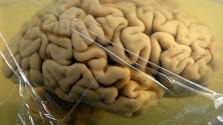 Slicing Up Human Brains -- Mind Blow #93