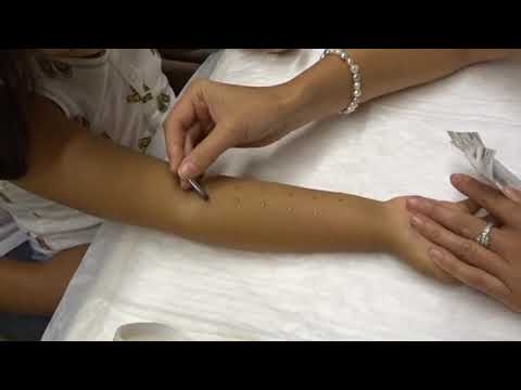 Pruebas Alergia en niños