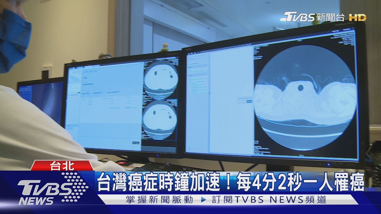 台灣癌症時鐘加速! 每4分2秒一人罹癌
