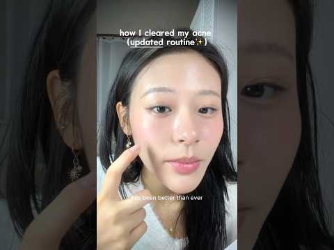 *not sponsored* how I cleared my acne (updated routine)✨