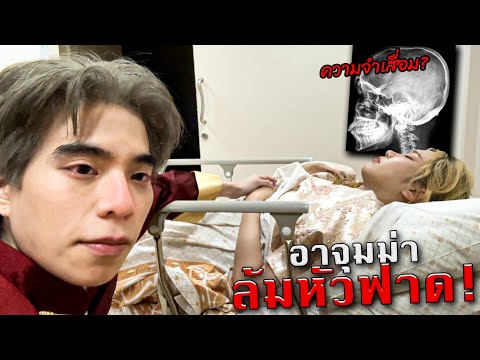 เข้าโรงบาลตี 2 กลัวแฟนความจำเสื่อม เพราะลื่นล้มตกบันไดบ้าน