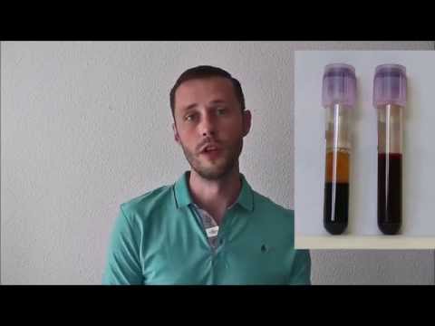 Blutgasanalyse: Fehlerquellen bei der Abnahme