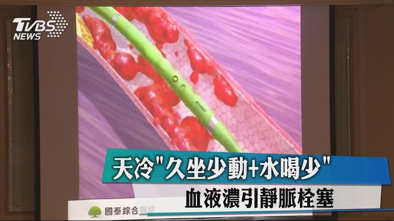 天冷!久坐少動、水喝少 血液濃引靜脈栓塞
