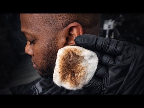 Day 2 Scalp Detox | Removing Deep Buildup From Bald Head @KendallSweatSr 