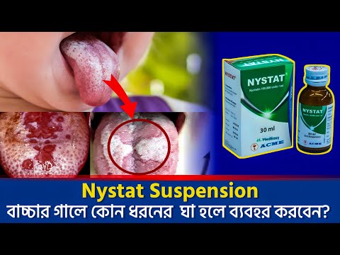 Nystat Drop (100,000 units/ml Suspension) এর কাজ, দাম, পার্শপ্রতিক্রিয়া | Nystatin Drop in Bangla