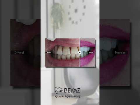 Klinik videolarımızı izleyin