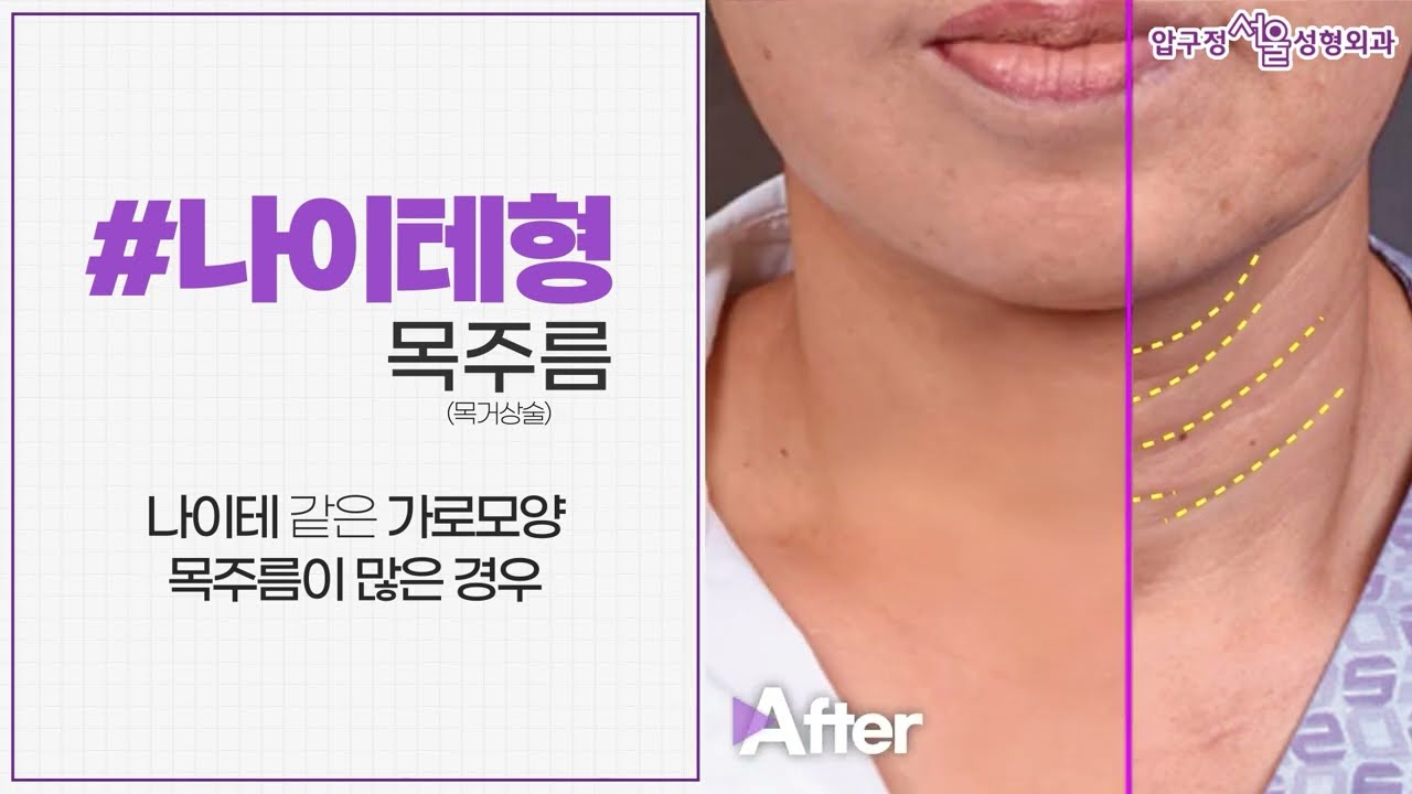 �� ���ָ��� ������?