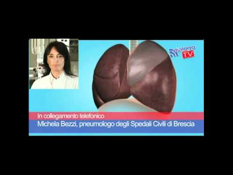 Se è possibile a ballare osteocondrosi Metodi tradizionali di cura del ginocchio